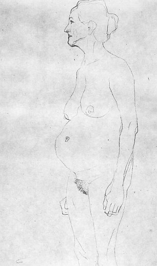 Gustav Klimt Akt einer aelteren Frau Wandbild